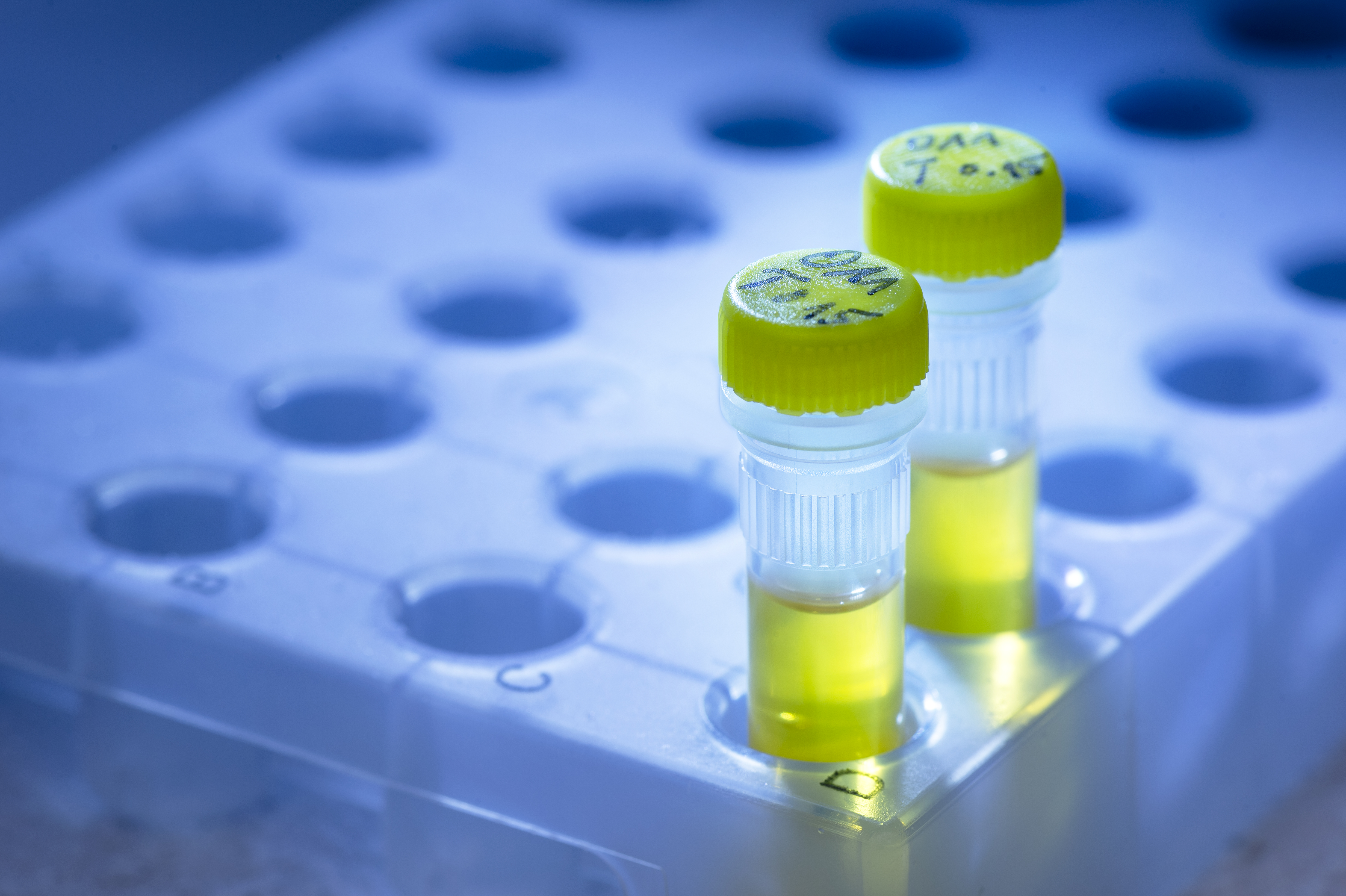 Two 1.5ml tubes with yellow lids and yellow liquid sitting in a transparent Eppi rack.